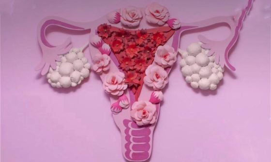 cancer de ovario descoberta inconformidades